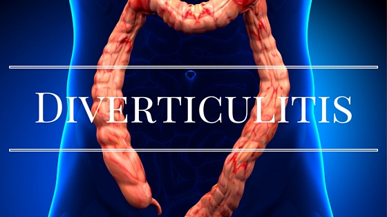 diverticulitis