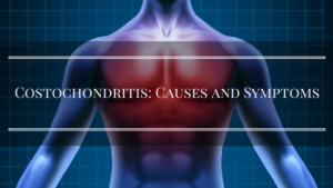 costochondritis